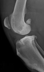 Arthrose 1