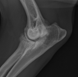 Arthrose 2